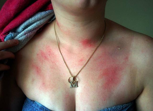 不能哭不能洗澡是什么病 因为不想洗澡哭了