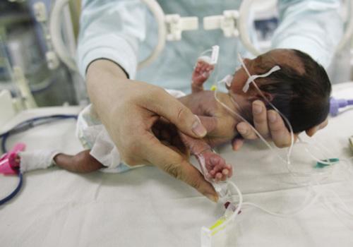 手掌婴儿是怎么回事（婴儿手掌总是打开）