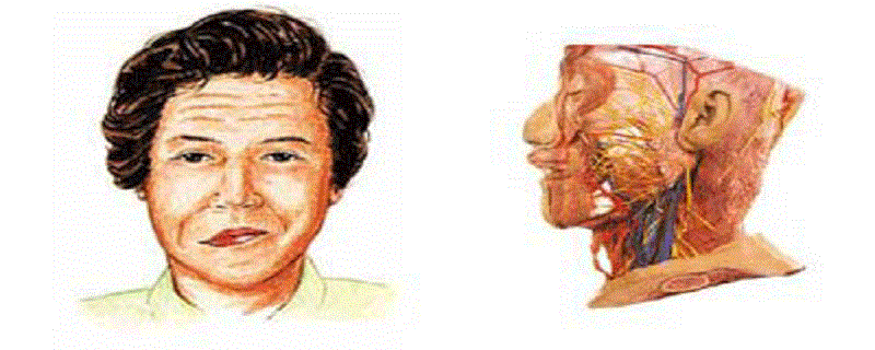 面神经麻痹会自愈吗 面神经麻痹会自愈吗能治好吗