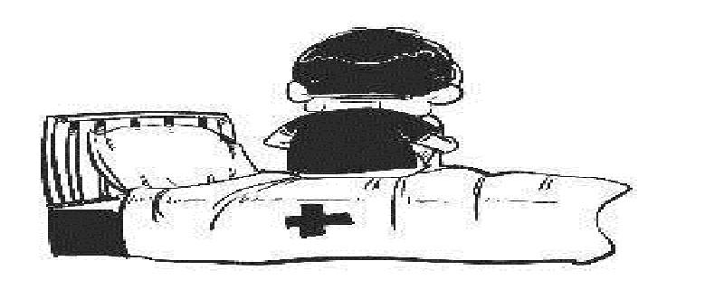 骨髓炎是怎么造成的（骨髓炎怎么导致的）