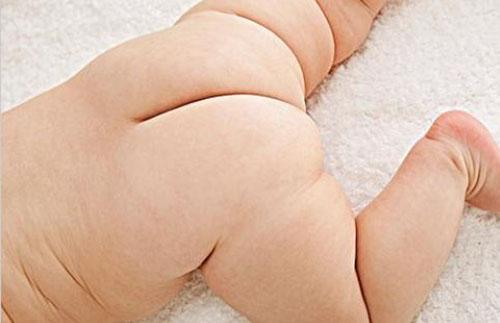 宝宝屁股红的原因(婴儿屁股红的原因)