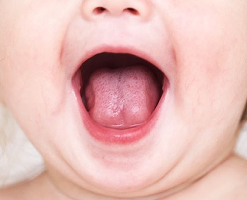 宝宝内热的症状 一岁多宝宝内热的症状