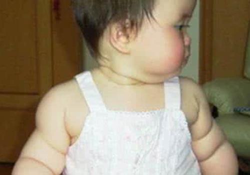 宝宝太胖有什么危害（宝宝太胖有什么危害图片）
