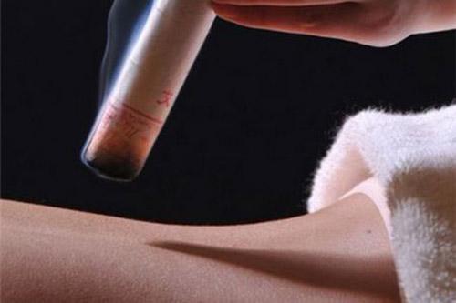 三九灸的好处（三九灸的好处与宣传）