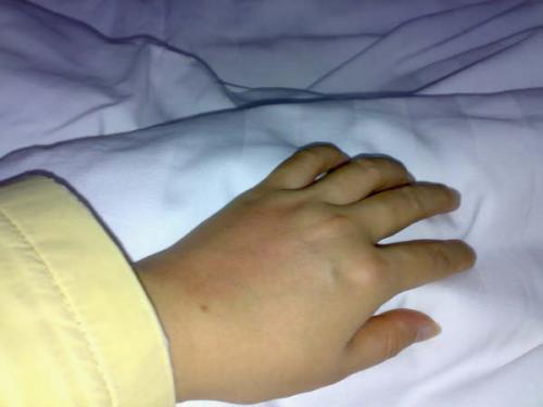 引起静脉炎的原因有（引起静脉炎的原因有哪些?如何处理?）