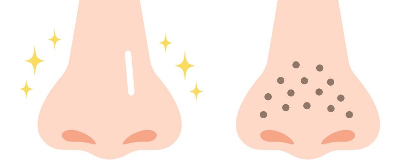 黑头导出液的危害 黑头导出液的副作用