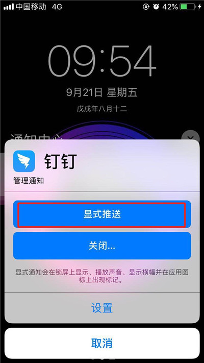 iphonexs怎么设置隐式推送