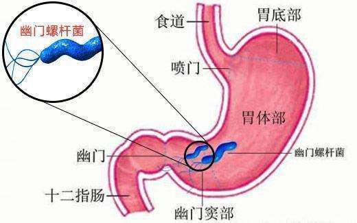 患幽门螺杆菌能接吻吗