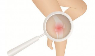 痛风应忌哪些食物 什么是痛风