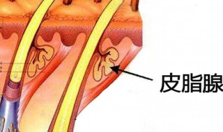 皮脂腺分泌旺盛怎么办 皮脂腺分泌旺盛解决方法