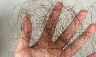 防脱发小窍门 这6个小窍门收藏一下