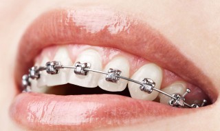 牙齿正畸仅仅是为了好看吗 牙齿正畸是不是为了好看