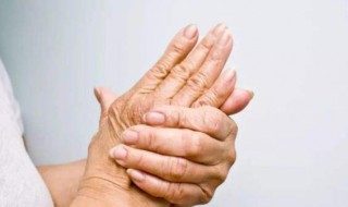 风湿病能彻底治愈吗 风湿病可以根治吗