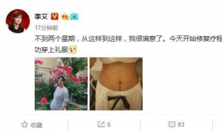 李艾产后晒肚皮照 网友希望她能出减肥教程