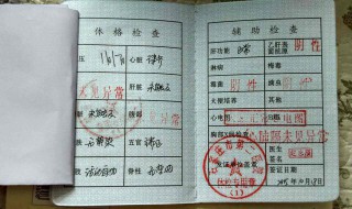 健康证要检查什么项目 健康证要检查项目介绍