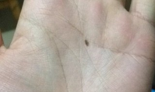 掌心有痣代表什么 掌心有痣代表什么意思