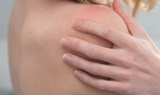 怎样驱赶人身上的跳蚤 如何驱赶人身上的跳蚤