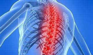 强直性脊柱炎怎么办 需要注意这些方面