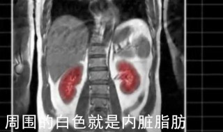 怎么知道是不是内脏脂肪多 如何知道内脏脂肪是不是多