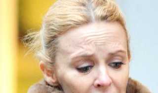 怎样能去掉抬头纹 去掉抬头纹的方法