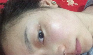 斑怎样才能清除 清除斑的方法