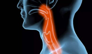 喉痹是什么意思 喉痹是啥意思