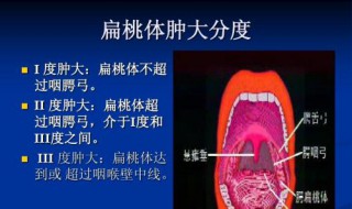 扁条体发炎怎样好得快 三个使扁条体好得快的方法