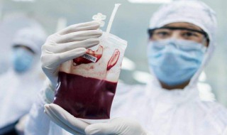 浆细胞乳腺炎能做全切手术吗 需根据临床表现判定治疗方法