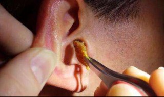 耳朵堵住了怎么办 耳朵出现闷堵的9个改善方法