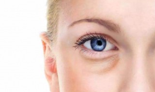 无针去眼袋能维持多久 甩掉眼睛浮肿