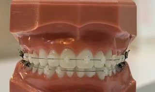 牙肉烂是什么原因 应该怎么做?