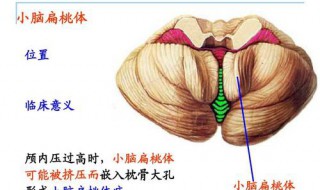 先天性小脑畸形积水怎么治疗 分享治疗小脑畸形积水的两个方法