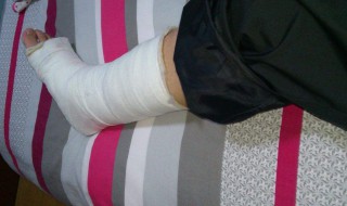 跌打骨折怎么治疗 跌打骨折治疗方法