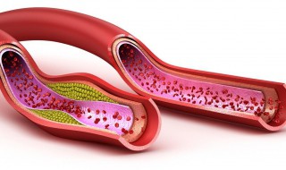 额头血管突出能用什么方法治疗 大家不妨了解一下