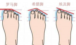 女性脚型分类 你是哪一种