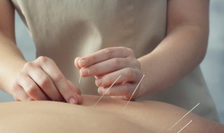 如何学针灸 学习针灸的方法分享