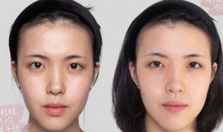 肤色不均怎么调理 肤色不均匀的主要原因：