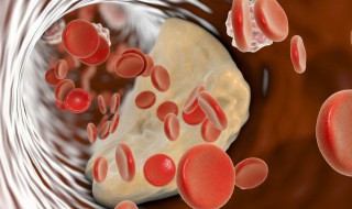 血脂是什么意思 血脂的意思是