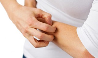 为什么睡到半夜皮肤痒 专家告诉你