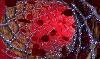 心脏支架价格 是什么材质