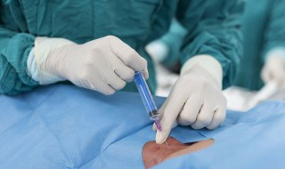 留置针穿刺技巧 怎样提高小儿留置针穿刺成功率