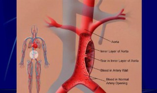 右位主动脉弓的人多吗 健康讲座