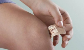 疤痕贴怎么用 疤痕贴的使用方法