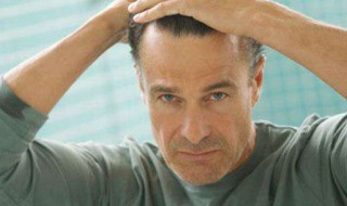 为何脸出现竖条纹 有什么命理所言