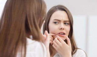 不长痘小技巧 为爱美的你支上几招