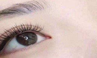 有黑眼袋怎么处理 有黑眼袋的处理方法