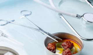 衣服沾到碘伏该怎么办 这些方法都很好用