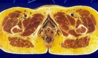 耻骨弓低是什么意思 耻骨弓低简单介绍