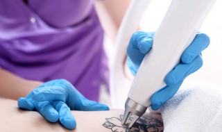 激光洗纹身留下的疤怎么办 激光洗纹身留疤后怎么办