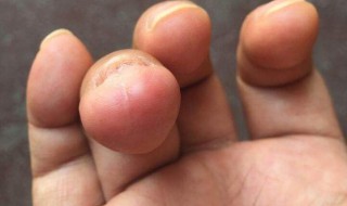 无名指长的人是什么命 看看这八点